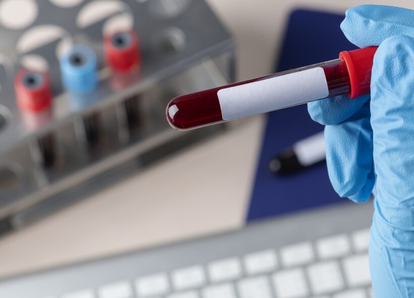 Evropský týden testování HIV a žloutenky začíná 20. listopadu. 