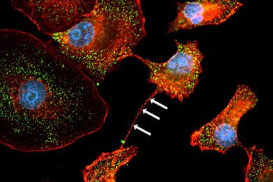 Snímek zachycuje nanotunely mezi dvěma nádorovými buňkami; šipky označují ribozomy zobrazené jako zelené tečky.
