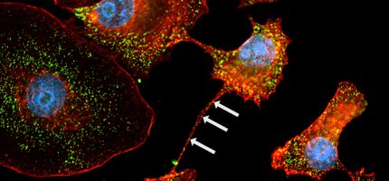 Snímek zachycuje nanotunely mezi dvěma nádorovými buňkami; šipky označují ribozomy zobrazené jako zelené tečky.