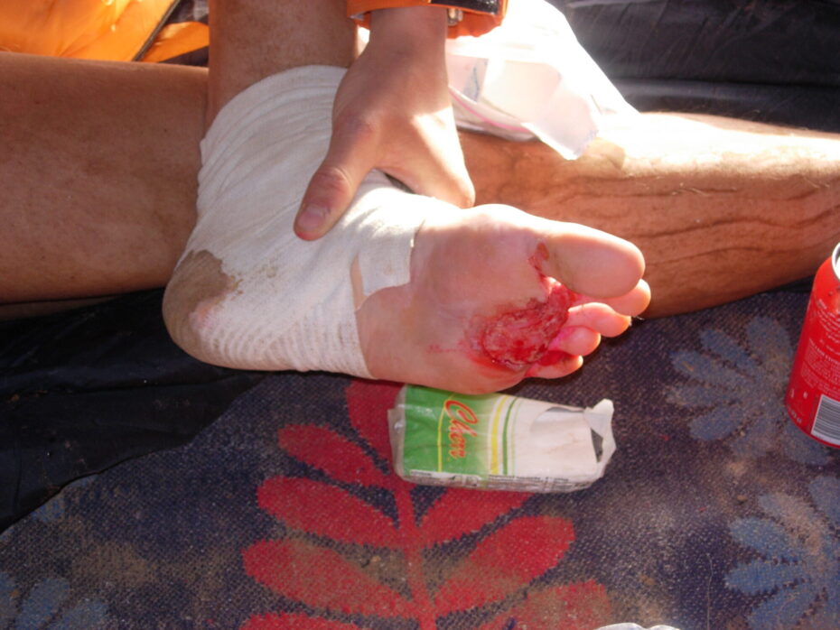 Ultramaraton si umí vybrat svou daň… 