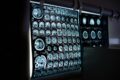 Snímky z magnetické rezonance patří k základním pilířům moderní diagnostiky. Odborníci varují, že navrhované regulace mohou dostupnost podobných vyšetření výrazně omezit.