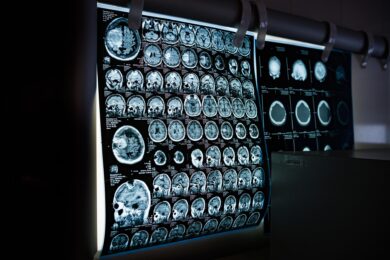 Snímky z magnetické rezonance patří k základním pilířům moderní diagnostiky. Odborníci varují, že navrhované regulace mohou dostupnost podobných vyšetření výrazně omezit.