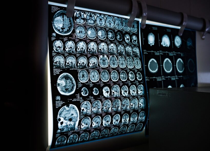 Snímky z magnetické rezonance patří k základním pilířům moderní diagnostiky. Odborníci varují, že navrhované regulace mohou dostupnost podobných vyšetření výrazně omezit.