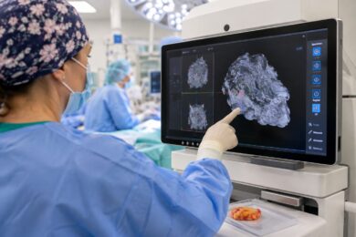 Moderní 3D zobrazování pomáhá chirurgům při operacích nádorů prsu.