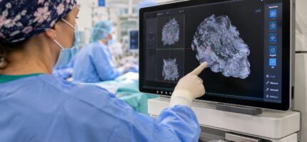 Moderní 3D zobrazování pomáhá chirurgům při operacích nádorů prsu.